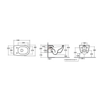 Globo 4ALL Унитаз-биде подвесной  54х36см, крепёж  в комплекте, цвет: белый, сиденье на выбор